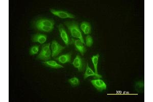 Immunofluorescence of monoclonal antibody to GMFB on HeLa cell. (GMFB 抗体  (AA 1-154))