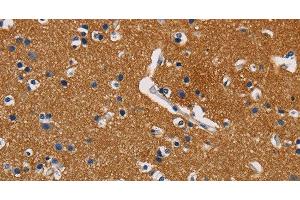 Immunohistochemistry of paraffin-embedded Human brain using GPM6A Polyclonal Antibody at dilution of 1:40 (GPM6A 抗体)