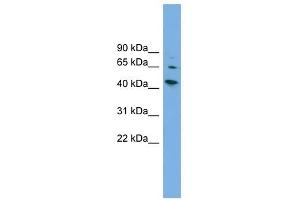 WIPF2 antibody used at 1 ug/ml to detect target protein. (WIPF2 抗体  (Middle Region))