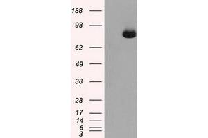 Image no. 6 for anti-Aconitase 2, Mitochondrial (ACO2) antibody (ABIN1496412) (ACO2 抗体)