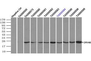 Image no. 4 for anti-Crystallin, alpha B (CRYAB) antibody (ABIN1497648) (CRYAB 抗体)