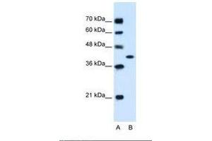 Image no. 2 for anti-Glutamic-Oxaloacetic Transaminase 2, Mitochondrial (Aspartate Aminotransferase 2) (GOT2) (AA 329-378) antibody (ABIN320796) (GOT2 抗体  (AA 329-378))