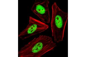 Fluorescent image of HeLa cells stained with Phospho-CDC25A Antibody A. (CDC25A 抗体  (pThr507))
