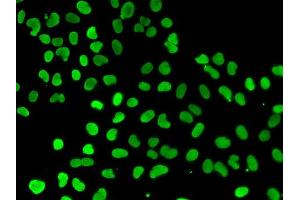 Immunofluorescence analysis of A549 cell using DNMT3L antibody. (DNMT3L 抗体)