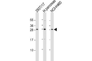 All lanes : Anti-COMTD1 Antibody (C-term) at 1:1000 dilution Lane 1: 293T/17 whole cell lysate Lane 2: human pancreas lysate Lane 3: NCI- whole cell lysate Lysates/proteins at 20 μg per lane.