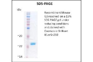 SDS-PAGE (SDS) image for Interleukin 6 (IL6) (Active) protein (ABIN5509357) (IL-6 蛋白)