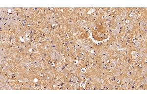 Detection of NME2 in Mouse Cerebrum Tissue using Polyclonal Antibody to Non Metastatic Cells 2, Protein NM23B Expressed In (NME2) (NME2 抗体  (AA 8-149))