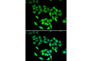 Immunofluorescence analysis of U2OS cells using CCT3 antibody. (CCT3 抗体  (AA 1-300))