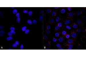 Immunocytochemistry/Immunofluorescence analysis using Mouse Anti-VPS35 Monoclonal Antibody, Clone 8A3 (ABIN6932966). (VPS35 抗体  (APC))