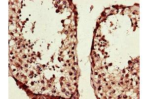 Immunohistochemistry (IHC) image for anti-Transcription Factor 3 (E2A Immunoglobulin Enhancer Binding Factors E12/E47) (TCF3) (AA 415-658) antibody (ABIN7172509)