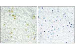 Immunohistochemistry analysis of paraffin-embedded human brain tissue, using MED14 Antibody. (MED14 抗体  (AA 701-750))