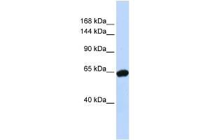 WB Suggested Anti-ZNF91 Antibody Titration:  0. (ZFP91 抗体  (N-Term))