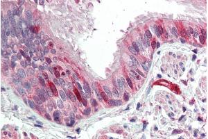 ABIN571026 (5µg/ml) staining of paraffin embedded Human Lung. (CNN3 抗体  (C-Term))
