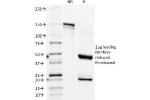 SDS-PAGE Analysis Purified PSAP Mouse Monoclonal Antibody (ACPP/1339). (ACPP 抗体)
