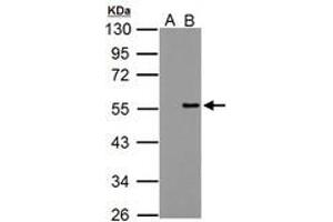 Image no. 1 for anti-Protein Phosphatase 4, Regulatory Subunit 2 (PPP4R2) (AA 1-360) antibody (ABIN1500387) (PPP4R2 抗体  (AA 1-360))