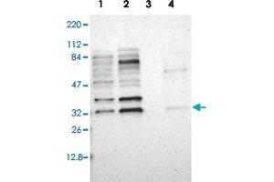 Western blot analysis of Lane 1: RT-4, Lane 2: U-251 MG, Lane 3: Liver, Lane 4: Tonsil with ZNF146 polyclonal antibody  at 1:250-1:500 dilution.
