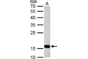 Western Blotting (WB) image for anti-Stathmin 1 (STMN1) (C-Term) antibody (ABIN2855912)