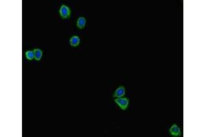 Immunofluorescent analysis of HepG2 cells using ABIN7178869 at dilution of 1:100 and Alexa Fluor 488-congugated AffiniPure Goat Anti-Rabbit IgG(H+L) (GAL4 抗体  (AA 1-324))