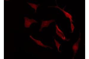 Immunofluorescence (fixed cells) (IF/ICC) image for anti-Solute Carrier Family 15 (Oligopeptide Transporter), Member 1 (SLC15A1) (Internal Region) antibody (ABIN6257773)