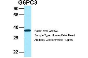 Western Blotting (WB) image for anti-Glucose 6-Phosphatase, Catalytic 3 (G6PC3) (N-Term) antibody (ABIN2789897)