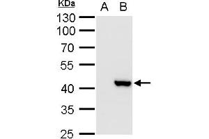 WB Image XRCC3 antibody detects XRCC3 protein by western blot analysis. (XRCC3 抗体)