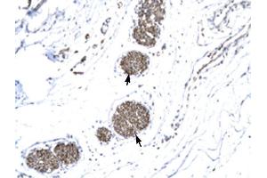MMP19 antibody was used for immunohistochemistry at a concentration of 4-8 ug/ml to stain Ganglionic cells (arrows) in Human urinary bladder. (MMP19 抗体  (N-Term))