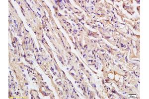 Formalin-fixed and paraffin embedded human endometrial tissue labeled with Anti XRCC4 Polyclonal Antibody, Unconjugated (ABIN1386856) at 1:200 followed by conjugation to the secondary antibody and DAB staining (XRCC4 抗体  (AA 151-260))