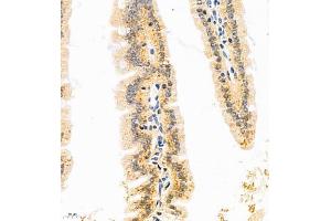 Immunohistochemistry of paraffin embedded mouse duodenum using GDPD2 (ABIN7074098) at dilution of 1:650 (400x lens) (GDPD2 抗体)
