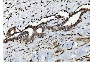 IHC analysis of Serum Response Factor/SRF using anti-Serum Response Factor/SRF antibody (ABIN7600144).