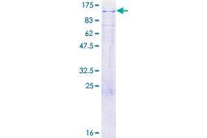 LRP3 Protein (AA 1-770) (GST tag)