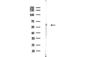 Western blot analysis of lysates from Mouse liver, using Smad2 Antibody at 1/1000 dilution.