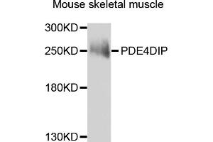 Western blot analysis of extracts of mouse skeletal muscle, using PDE4DIP antibody. (PDE4DIP 抗体)