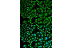 Immunofluorescence analysis of MCF-7 cells using CTSA antibody (ABIN5973211). (CTSA 抗体)