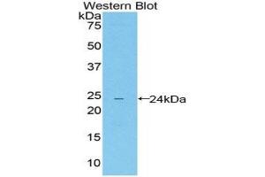 Western Blotting (WB) image for anti-Leukocyte Immunoglobulin-Like Receptor, Subfamily B (With TM and ITIM Domains), Member 4 (LILRB4) (AA 24-206) antibody (ABIN1859666) (LILRB4 抗体  (AA 24-206))