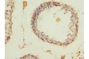 Immunohistochemistry of paraffin-embedded human testis tissue using ABIN7176048 at dilution of 1:100 (ZCCHC4 抗体  (AA 25-229))