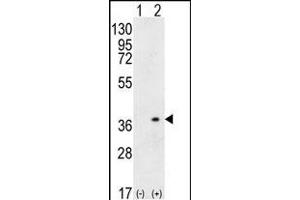 Western blot analysis of HLA-DQA1 (arrow) using rabbit polyclonal HLA-DQA1 Antibody (N-term) (ABIN656108 and ABIN2837859). (HLA-DQA1 抗体  (N-Term))