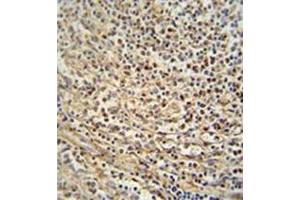 Immunohistochemistry analysis in formalin fixed and paraffin embedded human spleen tissue reacted with Gasdermin C Antibody (Center) followed by peroxidase conjugation of the secondary antibody and DAB staining. (MLZE 抗体  (Middle Region))
