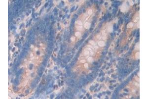 Detection of UBD in Rat Small intestine Tissue using Polyclonal Antibody to Ubiquitin D (UBD)