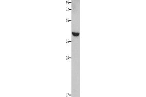 Western Blotting (WB) image for anti-Matrix Metallopeptidase 28 (MMP28) antibody (ABIN2421863) (MMP28 抗体)