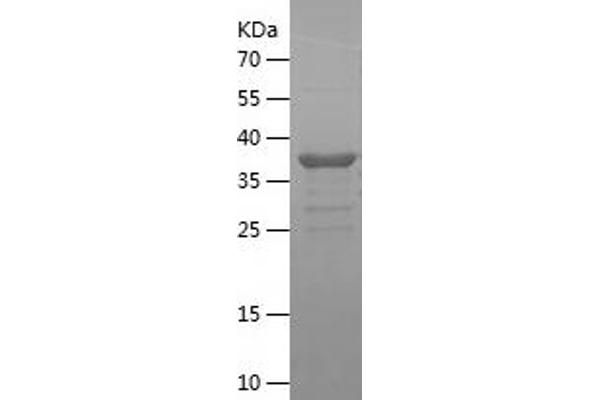 p21 Protein (AA 2-164) (His-IF2DI Tag)