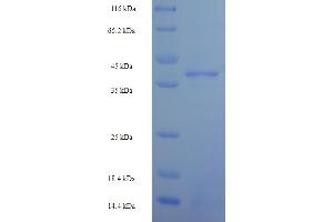 SDS-PAGE (SDS) image for Zinc Finger Protein 581 (ZNF581) (AA 1-197), (full length) protein (His-SUMO Tag) (ABIN5710654)