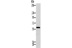Western blot analysis of Human kidney tissue using ZNF248 Polyclonal Antibody at dilution of 1:200 (ZNF248 抗体)