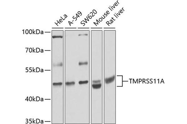 TMPRSS11A 抗体  (AA 300-421)