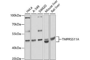 Western blot analysis of extracts of various cell lines, using TMPRSS11A antibody (ABIN6133161, ABIN6149279, ABIN6149281 and ABIN6224715) at 1:1000 dilution. (TMPRSS11A 抗体  (AA 300-421))