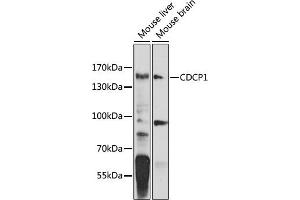Western blot analysis of extracts of various cell lines, using CDCP1 antibody (ABIN6129363, ABIN6138276, ABIN6138278 and ABIN6224269) at 1:1000 dilution.