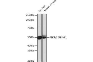 Western blot analysis of extracts of various cell lines, using PEDF/SERPINF1 Rabbit mAb (ABIN7270247) at 1:1000 dilution.
