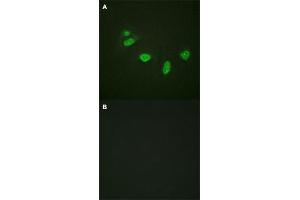 Immunofluorescence staining of methanol-fixed HeLa cells with ETS1 (phospho T38) polyclonal antibody  without blocking peptide (A) or preincubated with blocking peptide (B) at 1:100-1:200 dilution. (ETS1 抗体  (pThr38))