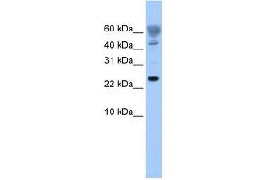 FUNDC1 antibody used at 1 ug/ml to detect target protein. (FUNDC1 抗体  (Middle Region))