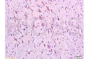 Formalin-fixed and paraffin embedded rat brain tissue labeled with Anti-DRD1 Polyclonal Antibody, Unconjugated (ABIN730843) at 1:300, followed by conjugation to the secondary antibody and DAB staining