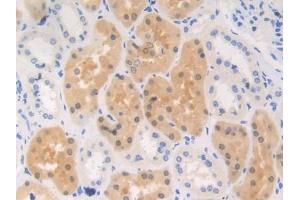 DAB staining on IHC-P; Samples: Human Kidney Tissue (RENBP 抗体  (AA 1-254))
